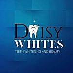 Daisy White - @daisywhite_teeth_whitening Instagram Profile Photo